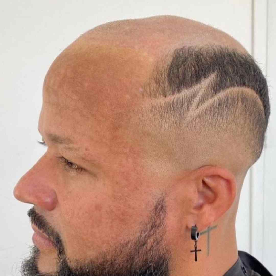 Prótese Capilar Personalizada – Pronta para Uso Imediato em Todo o Brasil