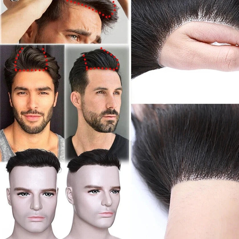 Franja Frontal Masculina e Feminina Liberte-se da calvície e abrace a naturalidade
