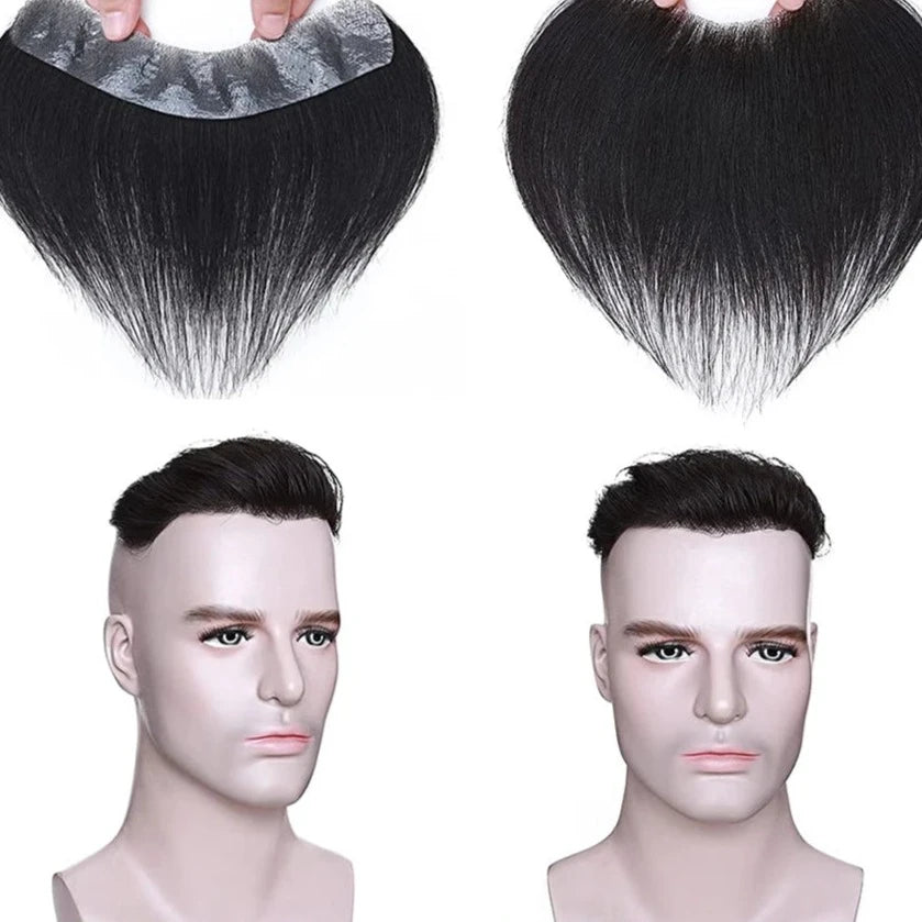 Franja Frontal Masculina e Feminina Liberte-se da calvície e abrace a naturalidade